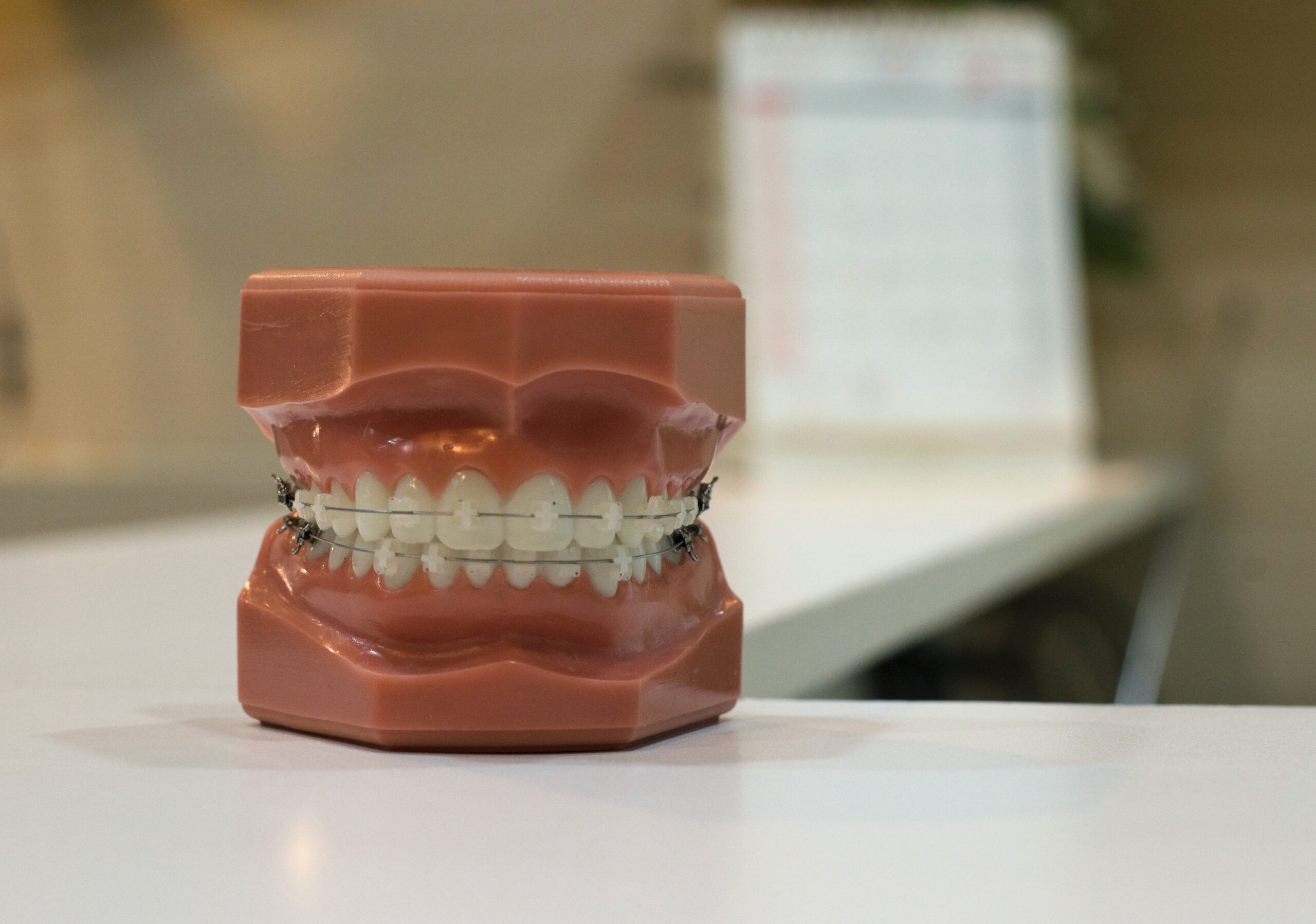 How do regular dental braces cost?  Ceramic braces, Dental braces,  Invisible braces